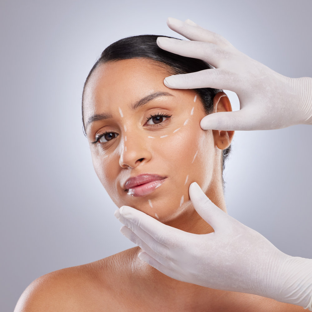 Dentist Cape Town | Thread Lifts